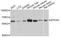 Epoxide Hydrolase 2 antibody, MBS127875, MyBioSource, Western Blot image 