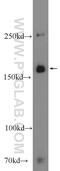 Homeobox protein cut-like 2 antibody, 24902-1-AP, Proteintech Group, Western Blot image 