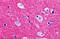 Regulating Synaptic Membrane Exocytosis 2 antibody, 4447, ProSci, Immunohistochemistry paraffin image 