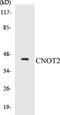 CCR4-NOT Transcription Complex Subunit 2 antibody, EKC1125, Boster Biological Technology, Western Blot image 
