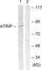 ATR Interacting Protein antibody, LS-C117796, Lifespan Biosciences, Western Blot image 