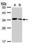 Metabolism Of Cobalamin Associated C antibody, NBP1-32513, Novus Biologicals, Western Blot image 