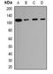 Lysosomal Associated Membrane Protein 2 antibody, orb382443, Biorbyt, Western Blot image 