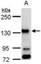 BUB1 Mitotic Checkpoint Serine/Threonine Kinase antibody, NBP1-31584, Novus Biologicals, Western Blot image 