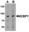 Nuclear Cap Binding Protein Subunit 1 antibody, TA319688, Origene, Western Blot image 