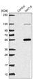 N-Acetyltransferase 16 (Putative) antibody, NBP1-93791, Novus Biologicals, Western Blot image 