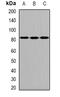 Arachidonate Lipoxygenase 3 antibody, abx141467, Abbexa, Western Blot image 