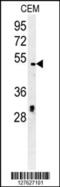 DNA Replication And Sister Chromatid Cohesion 1 antibody, 61-568, ProSci, Western Blot image 