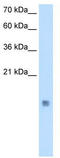 Stefin-B antibody, TA338386, Origene, Western Blot image 