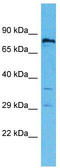Ring Finger Protein 19B antibody, TA331613, Origene, Western Blot image 