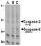 Caspase 2 antibody, TA306194, Origene, Western Blot image 