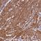 Coiled-Coil Domain Containing 102B antibody, NBP1-89260, Novus Biologicals, Immunohistochemistry paraffin image 