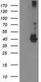 Microtubule-associated protein RP/EB family member 2 antibody, TA502859, Origene, Western Blot image 