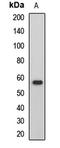 HCK Proto-Oncogene, Src Family Tyrosine Kinase antibody, LS-C668069, Lifespan Biosciences, Western Blot image 
