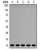 NADH dehydrogenase [ubiquinone] 1 beta subcomplex subunit 5, mitochondrial antibody, orb381907, Biorbyt, Western Blot image 