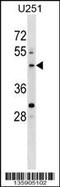 Pleckstrin Homology Domain Containing O2 antibody, 58-596, ProSci, Western Blot image 