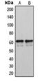Cytochrome P450 Family 2 Subfamily U Member 1 antibody, LS-C353611, Lifespan Biosciences, Western Blot image 