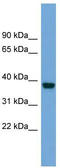 Protein ATP1B4 antibody, TA341890, Origene, Western Blot image 