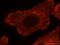 LIM domain and actin-binding protein 1 antibody, 16639-1-AP, Proteintech Group, Immunofluorescence image 