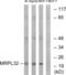 Mitochondrial Ribosomal Protein L32 antibody, abx014087, Abbexa, Western Blot image 