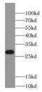 Serine And Arginine Rich Splicing Factor 1 antibody, FNab00630, FineTest, Western Blot image 