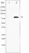 Protein kinase C delta type antibody, TA327884, Origene, Western Blot image 