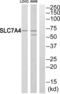 Solute Carrier Family 7 Member 4 antibody, PA5-39081, Invitrogen Antibodies, Western Blot image 