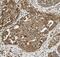 Small Nuclear Ribonucleoprotein Polypeptides B And B1 antibody, FNab08070, FineTest, Immunohistochemistry paraffin image 