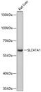 Solute Carrier Family 47 Member 1 antibody, GTX66266, GeneTex, Western Blot image 