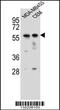 Forkhead Box D4 antibody, 56-263, ProSci, Western Blot image 