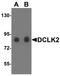 Doublecortin Like Kinase 2 antibody, A09671-1, Boster Biological Technology, Western Blot image 