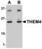 Thioesterase Superfamily Member 4 antibody, TA306801, Origene, Western Blot image 