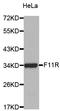 F11 Receptor antibody, orb49144, Biorbyt, Western Blot image 