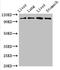 Mitogen-Activated Protein Kinase Kinase Kinase 13 antibody, CSB-PA013421LA01HU, Cusabio, Western Blot image 