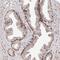 Zinc Finger Protein 502 antibody, HPA029557, Atlas Antibodies, Immunohistochemistry paraffin image 
