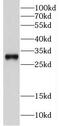 Cleavage And Polyadenylation Specific Factor 4 antibody, FNab01939, FineTest, Western Blot image 