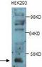 E3 ubiquitin-protein ligase TRIM13 antibody, TA310079, Origene, Western Blot image 