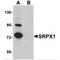 Sushi Repeat Containing Protein X-Linked antibody, MBS151426, MyBioSource, Western Blot image 
