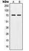hPot1 antibody, LS-C353386, Lifespan Biosciences, Western Blot image 