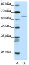 Regulatory Factor X5 antibody, TA335175, Origene, Western Blot image 