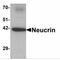 Dorsal Inhibitory Axon Guidance Protein antibody, MBS150960, MyBioSource, Western Blot image 