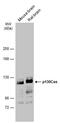 BCAR1 Scaffold Protein, Cas Family Member antibody, PA5-78381, Invitrogen Antibodies, Western Blot image 