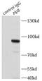 Solute Carrier Family 39 Member 8 antibody, FNab09643, FineTest, Immunoprecipitation image 