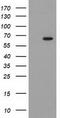 Glucokinase regulatory protein antibody, CF502152, Origene, Western Blot image 
