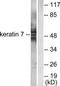 Keratin 7 antibody, TA312235, Origene, Western Blot image 