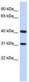Terminal Nucleotidyltransferase 5D antibody, TA338893, Origene, Western Blot image 