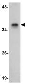 Jumonji Domain Containing 8 antibody, GTX31388, GeneTex, Western Blot image 