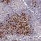 Solute Carrier Family 11 Member 1 antibody, HPA029590, Atlas Antibodies, Immunohistochemistry paraffin image 