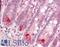 Muscular LMNA-interacting protein antibody, LS-B8800, Lifespan Biosciences, Immunohistochemistry paraffin image 