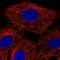 Ankyrin Repeat And FYVE Domain Containing 1 antibody, HPA065849, Atlas Antibodies, Immunofluorescence image 